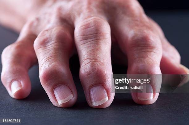 arthitis hand - osteoarthritis stock pictures, royalty-free photos & images