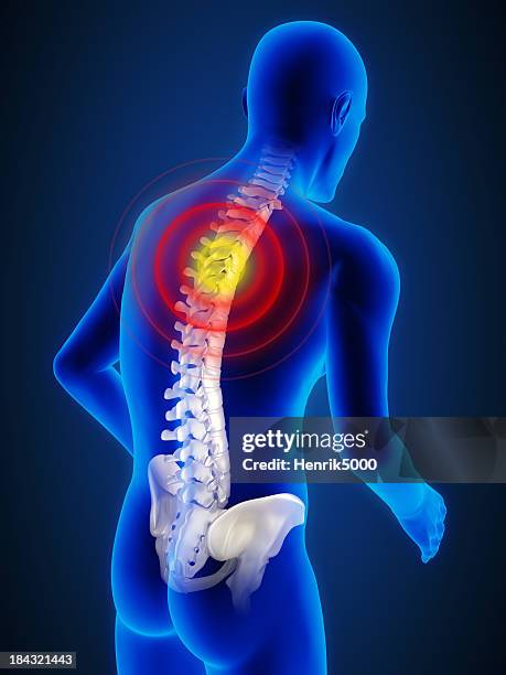 coluna dentro do corpo humano - corcunda imagens e fotografias de stock