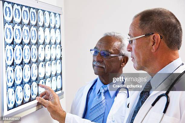 doctors consulting on x-ray - gchutka stock pictures, royalty-free photos & images