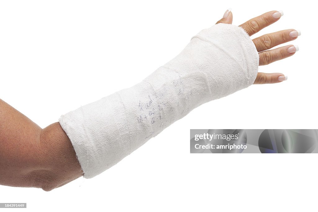 Gipsverband arm