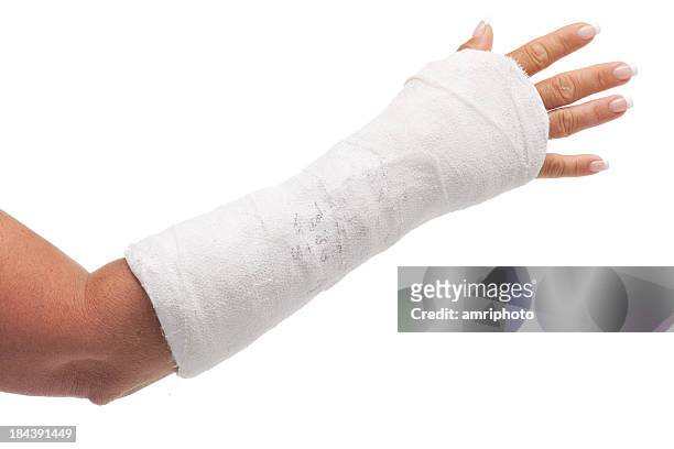 2,126 Arm Cast Stock Photos, High-Res Pictures, and Images - Getty Images
