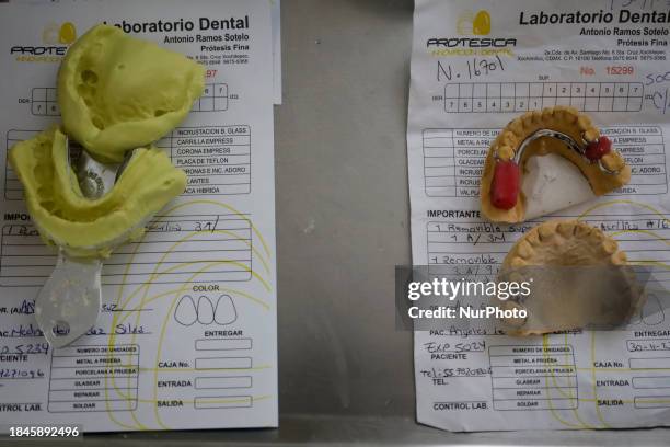 Dental impressions are being viewed inside the Centro de Odontogeriatria Centro de Salud TIII Doctor Guillermo Roman y Carrillo, located in the...