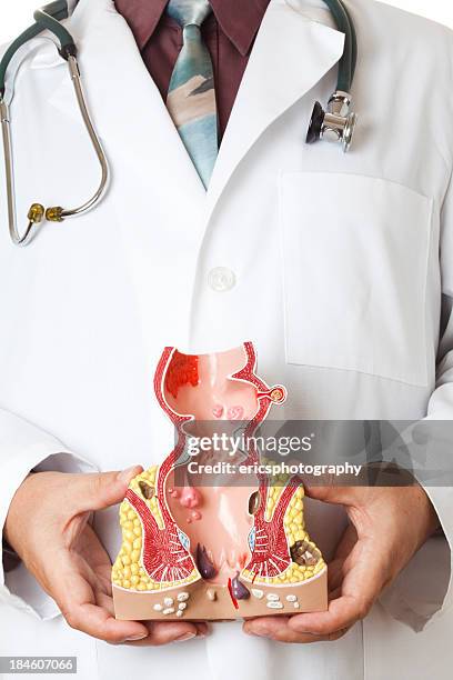 rectum - amoebic colitis stock pictures, royalty-free photos & images
