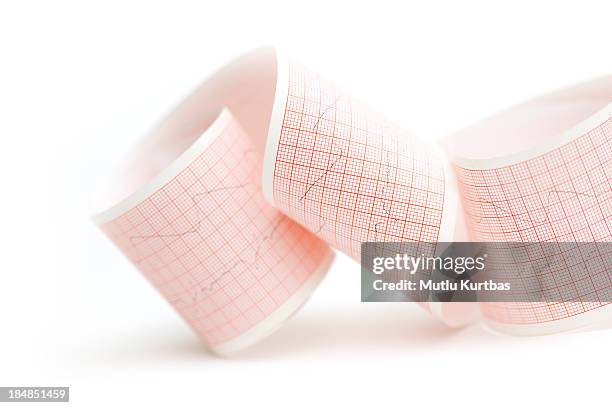 ecg - hartmonitor stockfoto's en -beelden