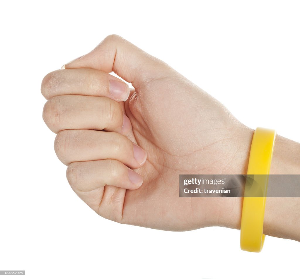 Gelbe Armband