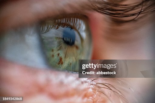 Eye pupil Eye pupil