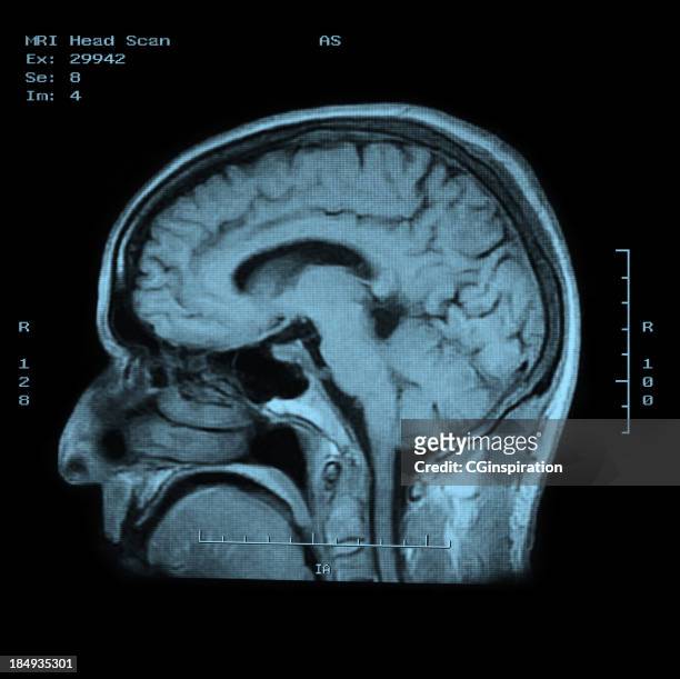 mri head scan side view - mri scan medische scan stockfoto's en -beelden