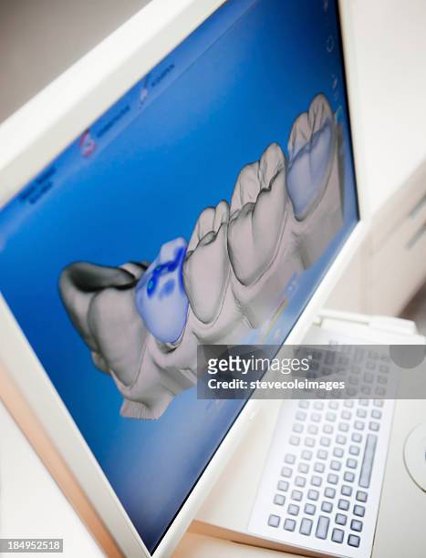 digitale x-ray menschlicher zahn - cat scan machine stock-fotos und bilder