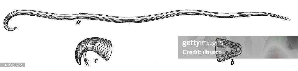 Giant Roundworm (Ascaris Lumbricoides)