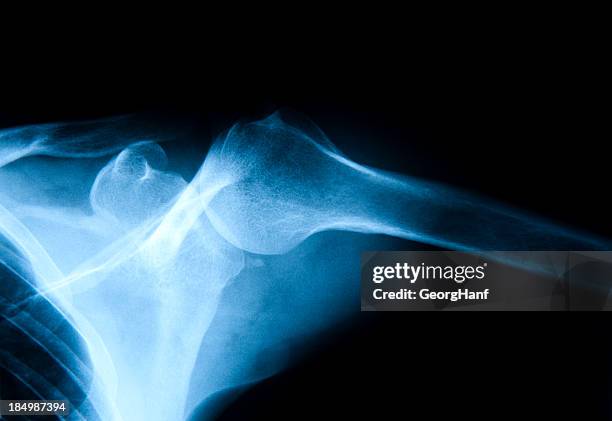 human shoulder - shoulder stock pictures, royalty-free photos & images