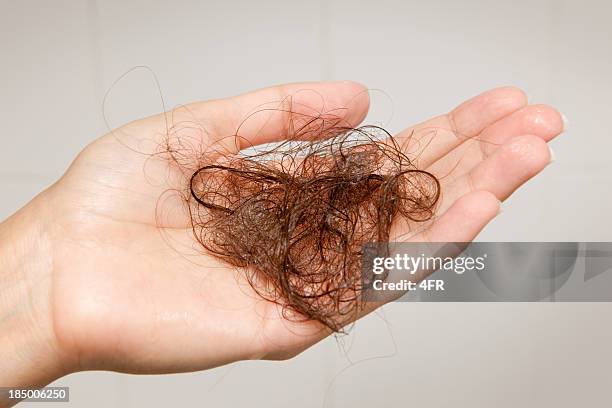 haarausfall-frau hält eine hairball (xxxl - haarausfall stock-fotos und bilder