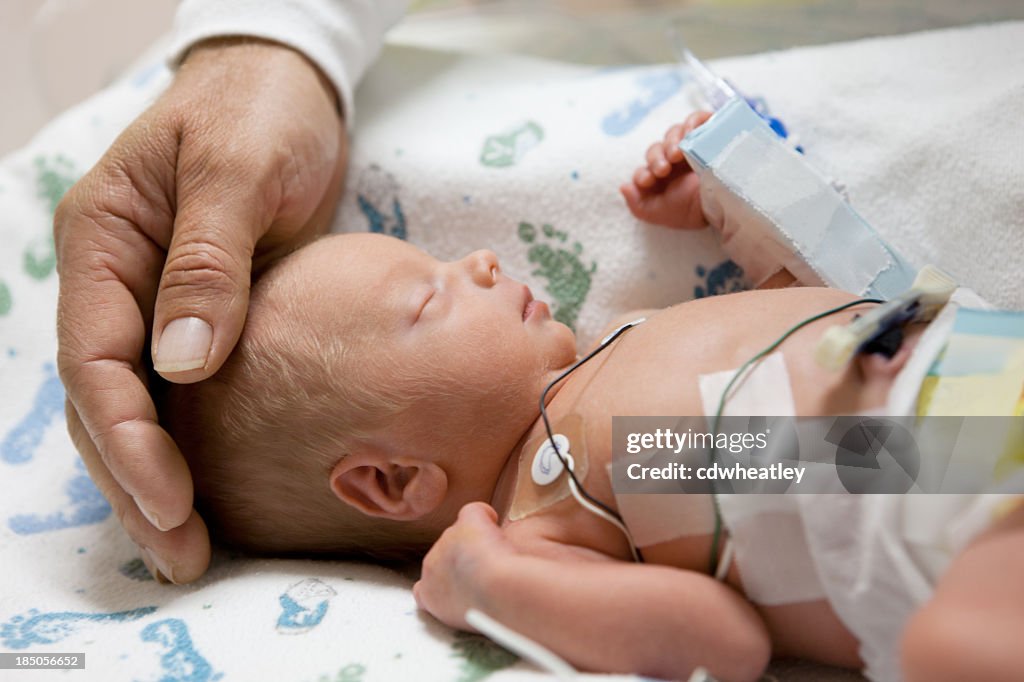 Vater berühren Kopf einer vorzeitigen baby in Brutkasten