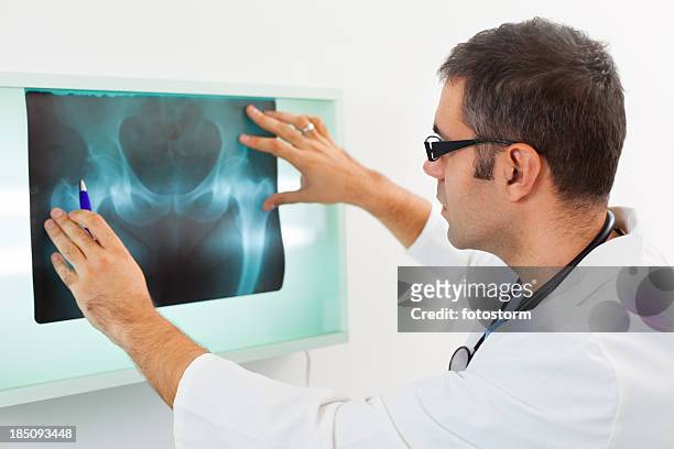 mid adult doctor examining x-ray image - hips stock pictures, royalty-free photos & images
