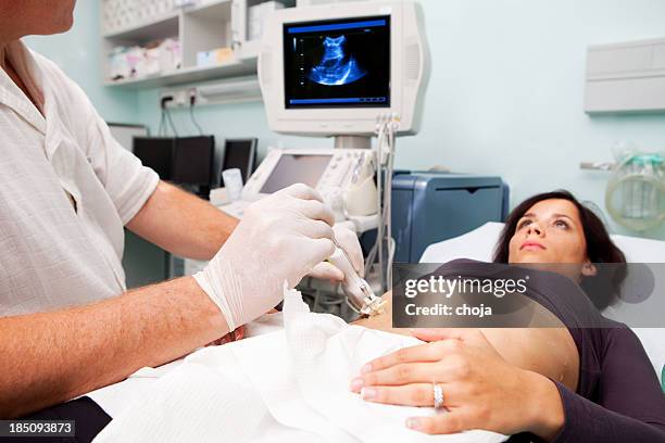 doctor is performing liver biopsy to women...supporting with ultrasound - liver stockfoto's en -beelden