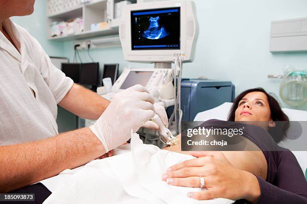 doctor is performing liver biopsy to women...supporting with ultrasound - stereostatic biopsy stock pictures, royalty-free photos & images