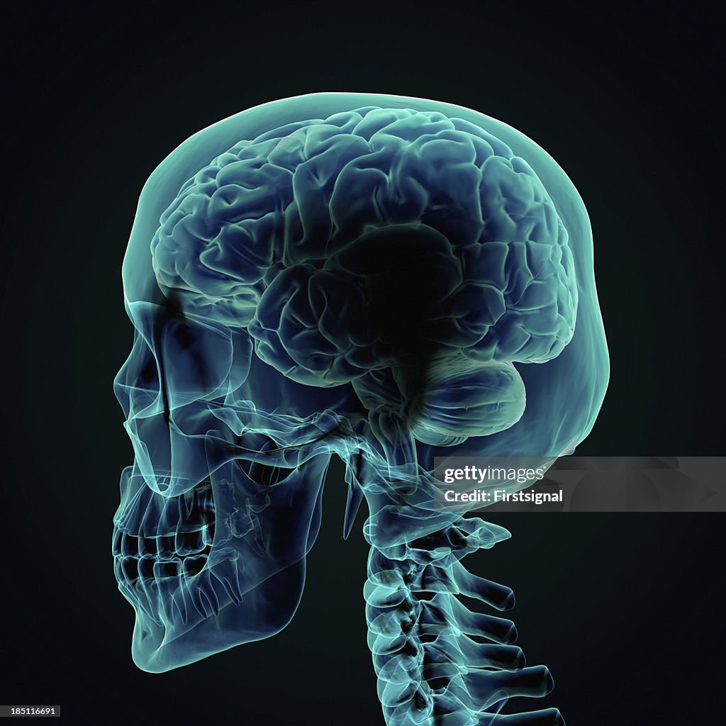 Human Brain X-ray style