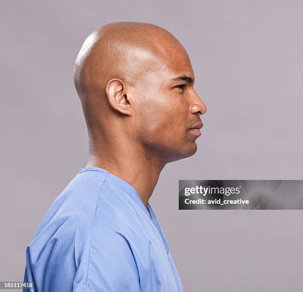 medical patient side profile-facing right - shaved head stockfoto's en -beelden