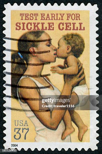 Sickle Cell Stamp, Stock-Foto