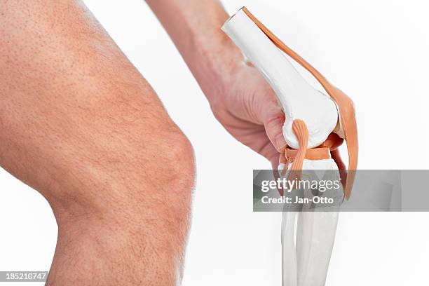 knee joint - cartilage bildbanksfoton och bilder