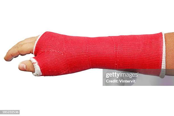 cast - scaphoid bone stock pictures, royalty-free photos & images