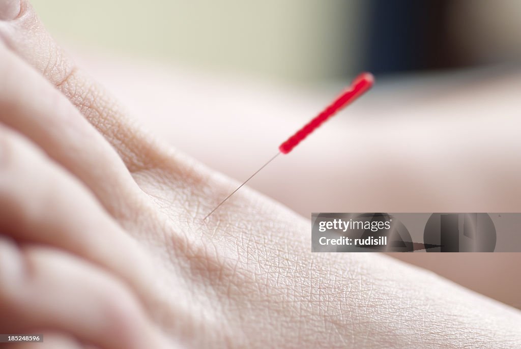 Acupuncture Foot