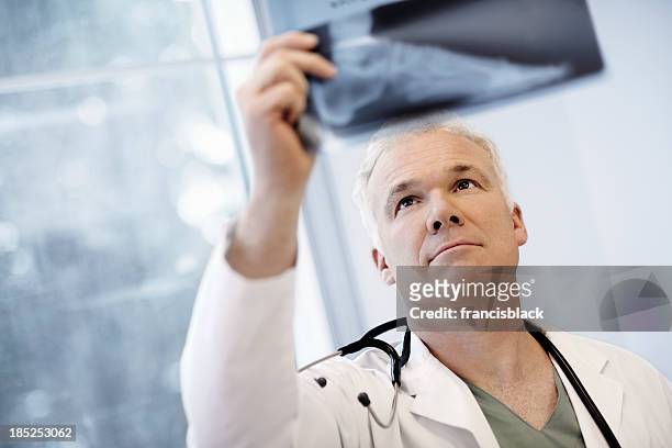 médico masculino examinando um raio-x imagem - male feet - fotografias e filmes do acervo