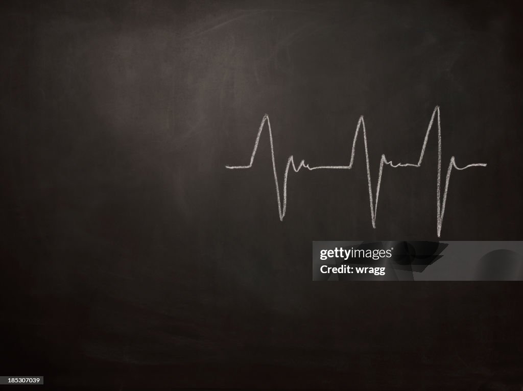 Heart Beat on a Blackboard