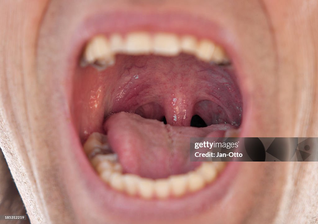 Male throat