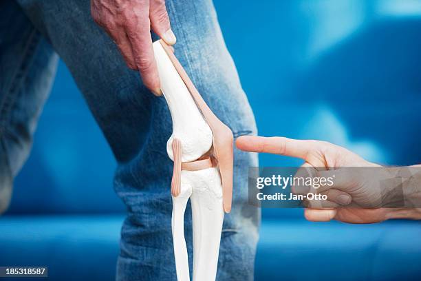 human knee joint - 退化性關節炎 個照片及圖片檔