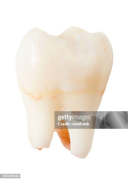 Paper Tooth Root 1,421 Tooth Roots Stock Photos, High-Res Pictures, and Images - Getty ...