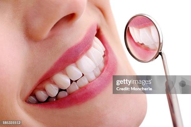 schönes lächeln mit dental spiegel - teeth whitening stock-fotos und bilder