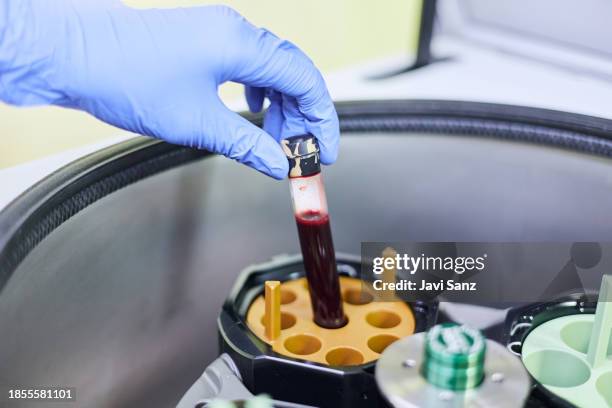 Lab Test Injuction 333 Lab Technicians Test Tubes Hands Blood Stock Photos, High-Res ...