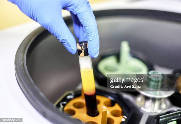 laboratory technician removing a test tube of blood sample in a centrifuge. - test strip stock pictures, royalty-free photos & images