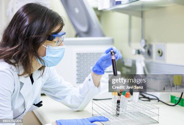 wissenschaftler hält ein röhrchen mit einer blutprobe in der hand, die für die analyse im labor bereit ist - südeuropa stock-fotos und bilder