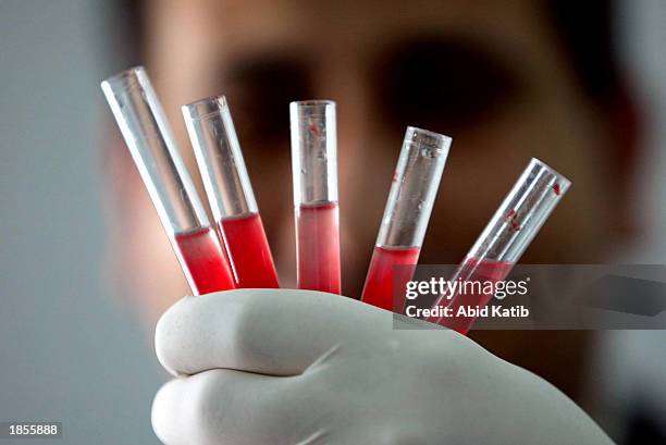 Palestinian laboratory worker checks blood units donated by members of the Palestinian public at Shifa hospital in Gaza City in the Gaza Strip on...