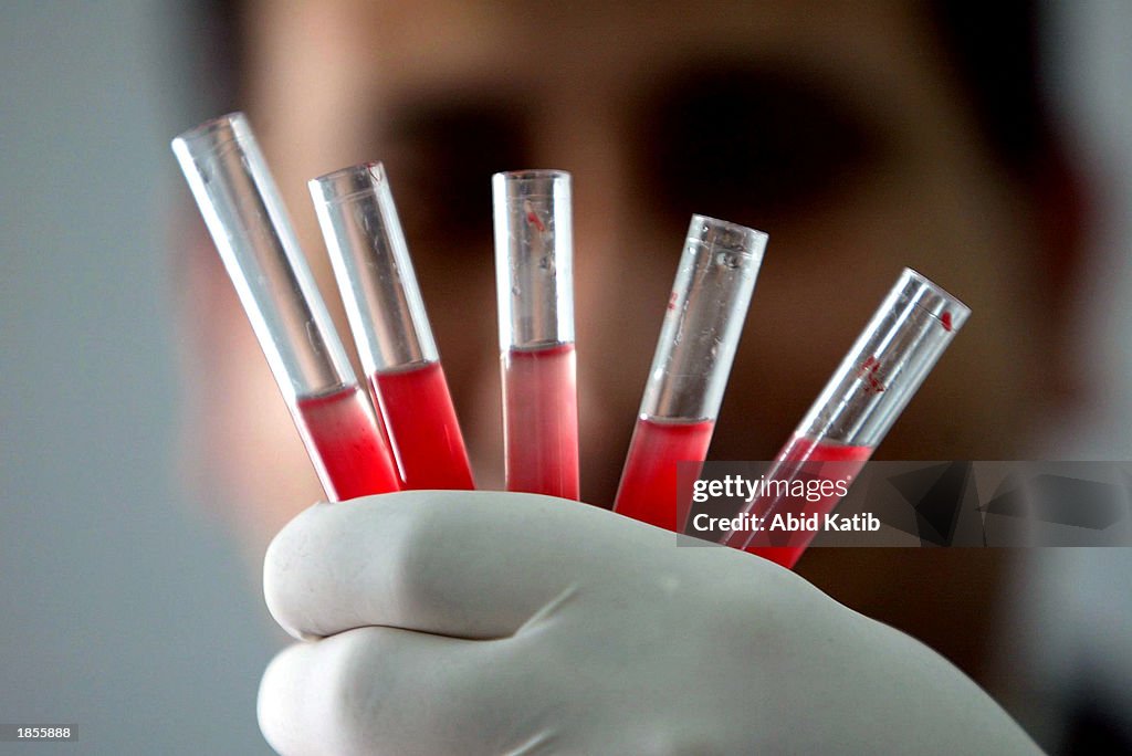 Palestinians Prepare Their Hospitals For Increased Military Action From Israel