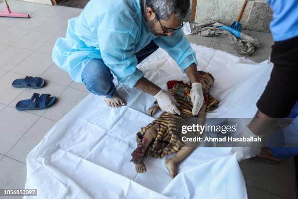 Young victim is attended to by medical staff on December 15, 2023 in Khan Yunis, Gaza. World Health Organisation's Executive Board adopted a rare...