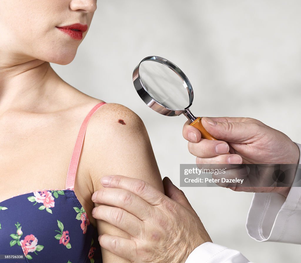 Dermatologist inspecting melanoma