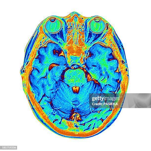Scan Heae Head Scans Photos and Premium High Res Pictures - Getty Images