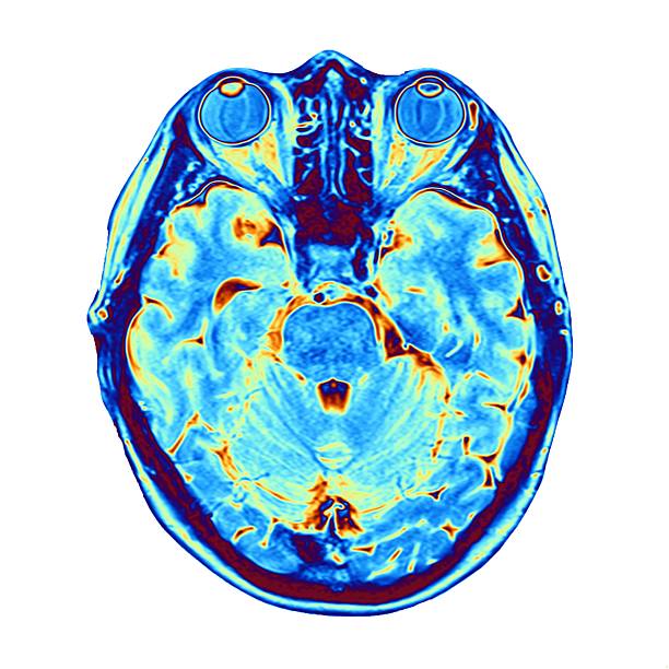 Brain Scan Label 8,865 Color Brain Scan Stock Photos, High-Res Pictures, and Images ...