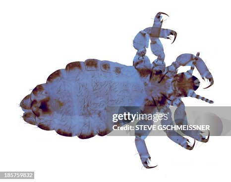 Head louse, light micrograph Head louse, light micrograph