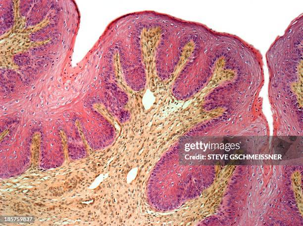 vaginal mucosa, light micrograph - plaveiselcelepitheel stockfoto's en -beelden