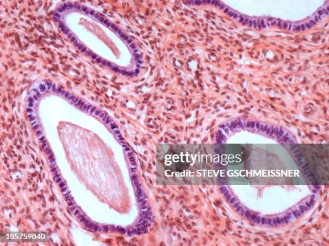 Cervix, light micrograph Cervix, light micrograph
