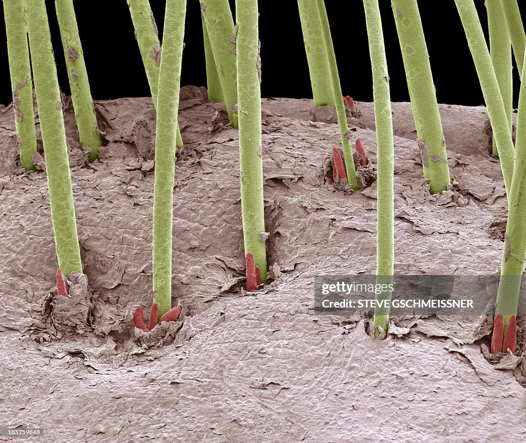Eyelash mites, SEM