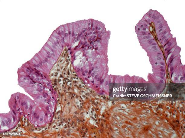 gall bladder lining, light micrograph - microscopie optique photos et images de collection