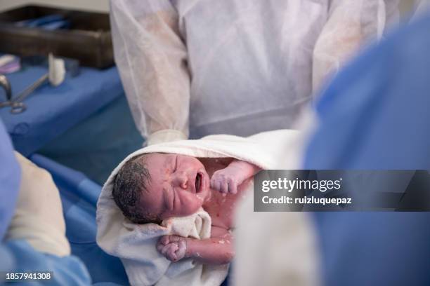 newborn baby in a cesarean section - labour childbirth stock pictures, royalty-free photos & images