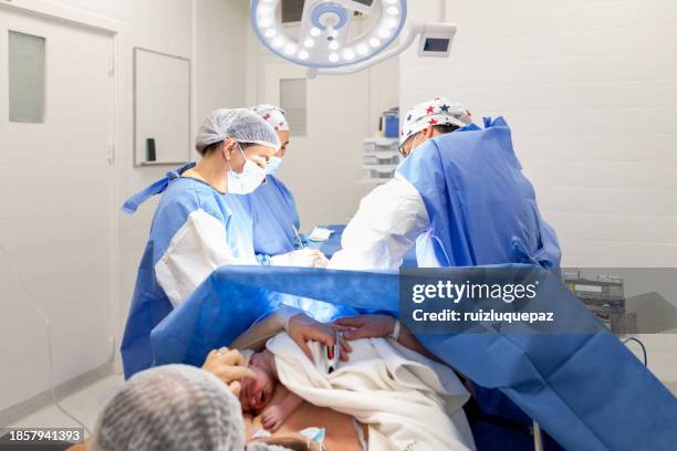 ärzte führen einen kaiserschnitt im operationssaal durch - halb mann halb frau stock-fotos und bilder