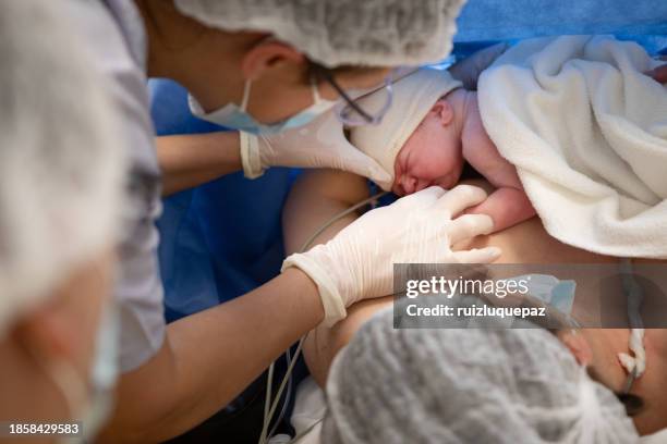 mother breastfeeds her newborn baby after a cesarean section - caesarean section stock pictures, royalty-free photos & images