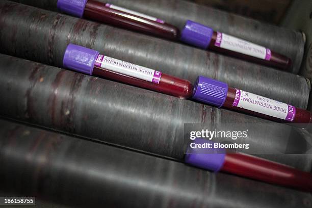 Blood samples sit in the pathology lab at the Acharya Tulsi Regional Cancer Treatment & Research Institute in Bikaner, Rajasthan, India on Thursday,...