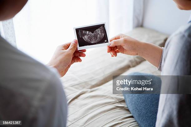 couple watching an ultrasonography of their baby - infertilidad fotografías e imágenes de stock